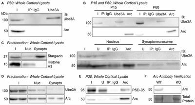 Activity-Dependent Arc Expression and Homeostatic Synaptic Plasticity Are Altered in Neurons from a Mouse Model of Angelman Syndrome